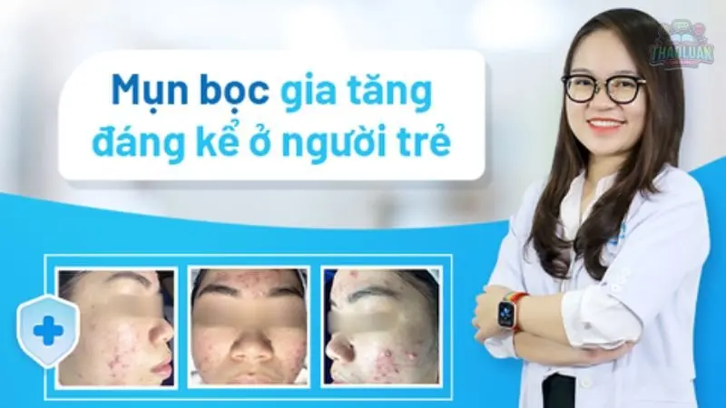 2. Dấu hiệu nhận biết mụn bọc là gì? 3