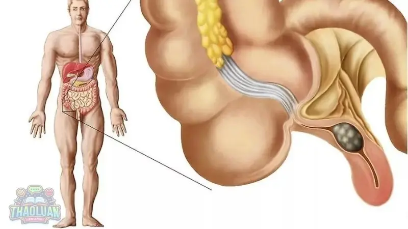 Nhận biết đau ruột thừa qua các triệu chứng