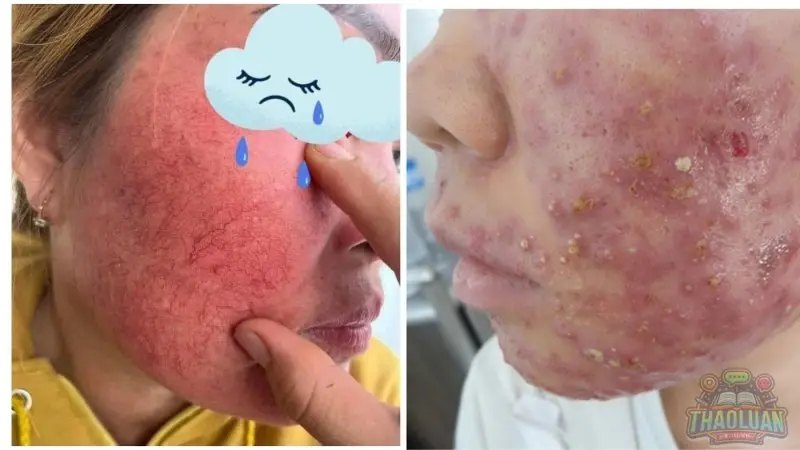 Tác hại của kem trộn