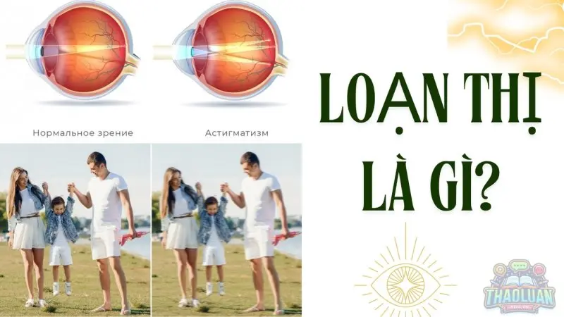 Cách nhận biết loạn thị tại nhà bạn cần biết 