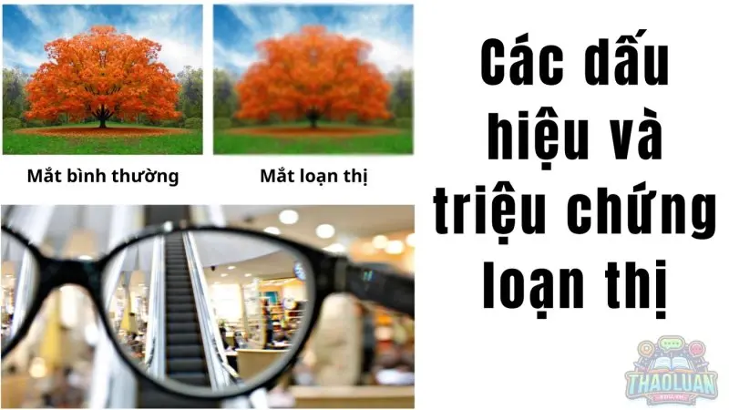 Các dấu hiệu và triệu chứng của loạn thị