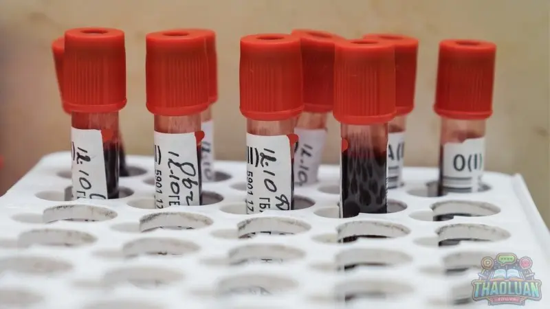 Cách nhận biết nhóm máu