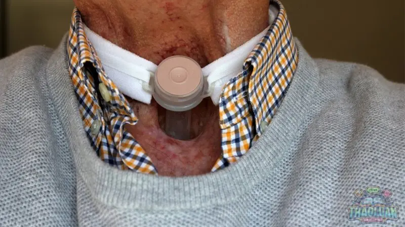 Cuộc sống sau ung thư tuyến giáp