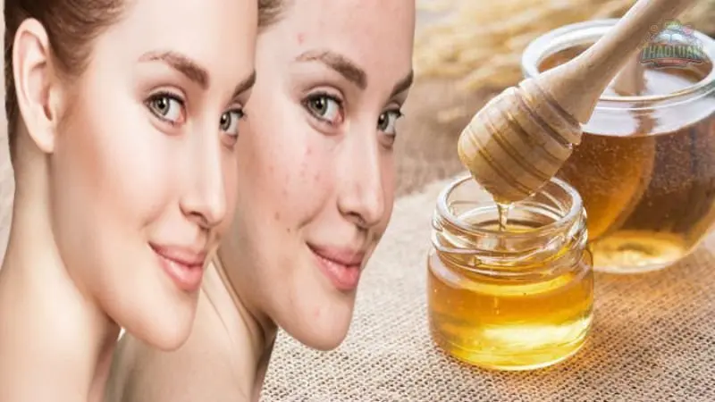 Nguyên nhân hình thành mụn ẩn 3