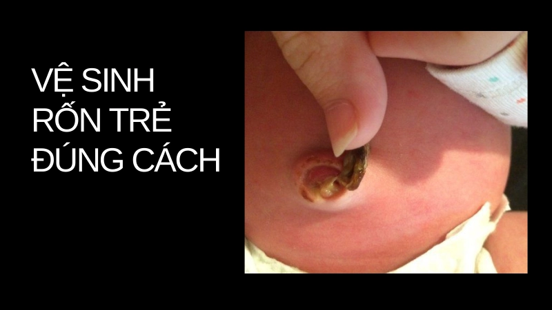 Cách tắm và vệ sinh rốn trẻ tránh bị nhiễm trùng